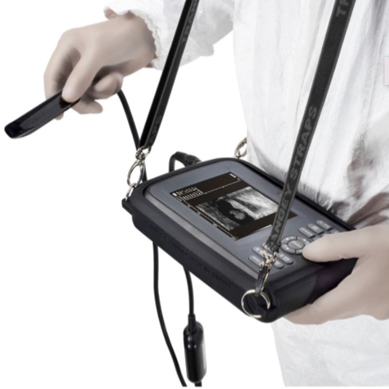 ECOGRAFO PORTATIL